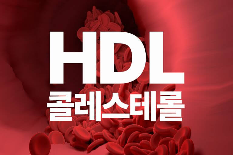 고밀도 콜레스테롤 높이는 방법